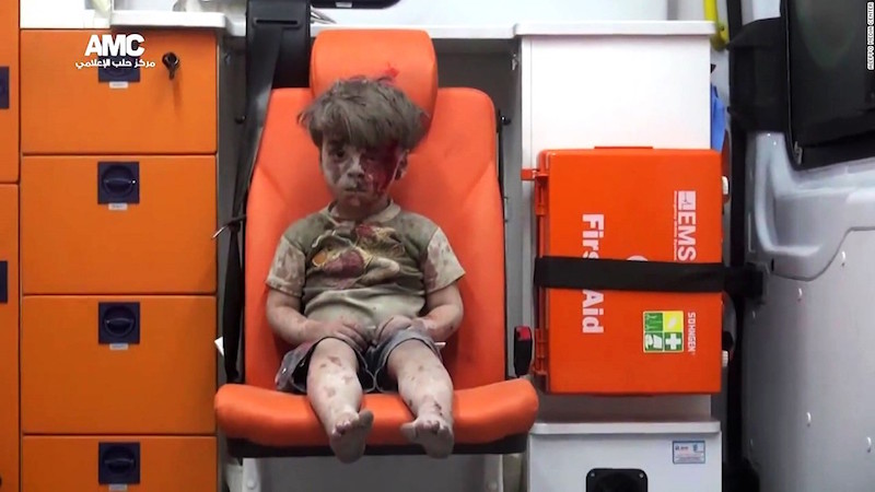 Omran Daqneesh